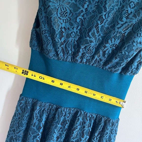 Anthropologie The Tommie Cap-Sleeve Front-Zip Shirt Dress Lace Edition Sz XS NWT - Picture 8 of 13